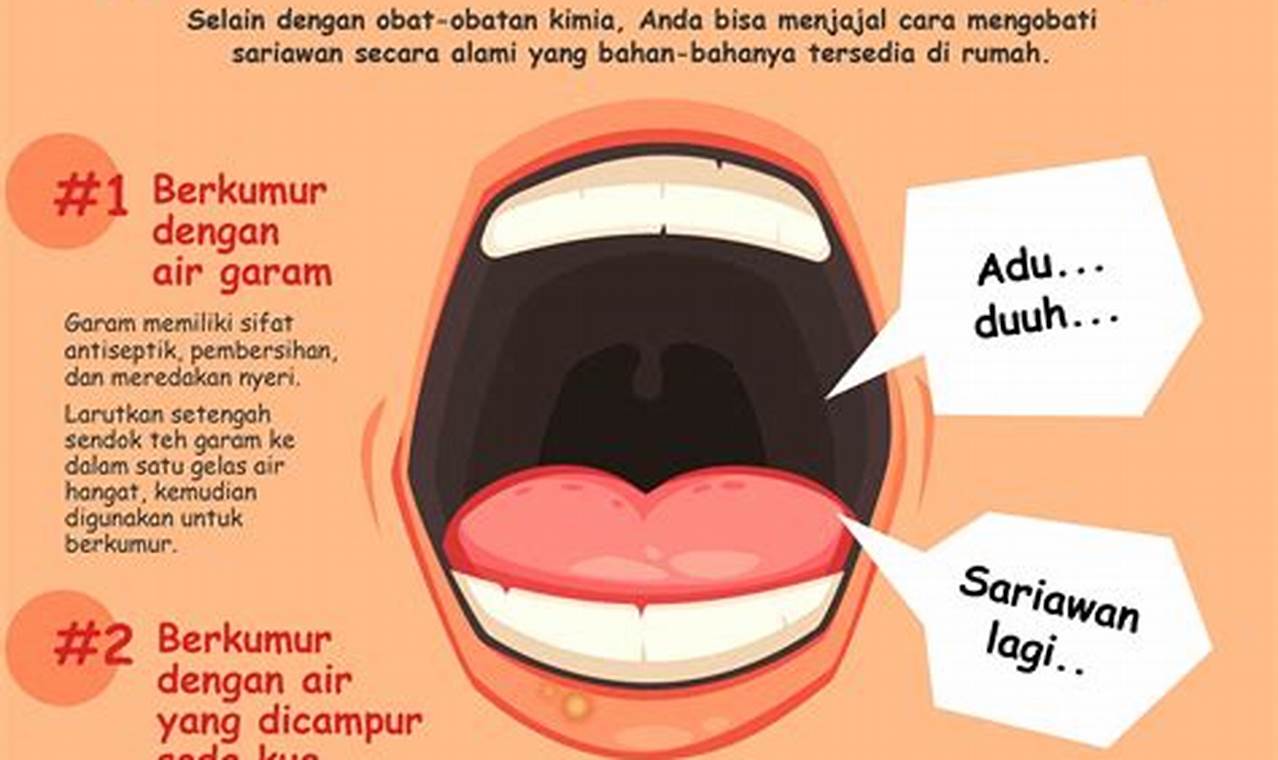 Cara Mengatasi Sariawan Dengan Mudah Dan Efektif
